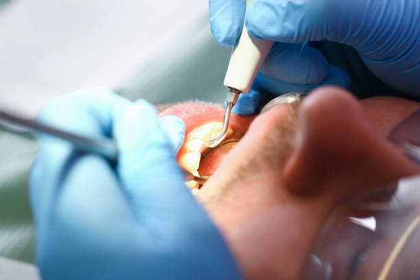 Best Cracked Tooth Emergency Dentist  in Gardner, MA
